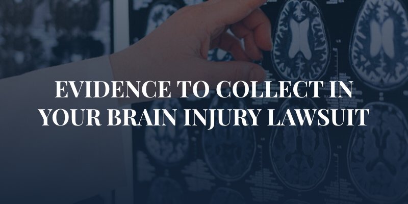 doctor pointing to a CAT Scan with the caption: "EVIDENCE TO COLLECT IN YOUR BRAIN INJURY LAWSUIT"